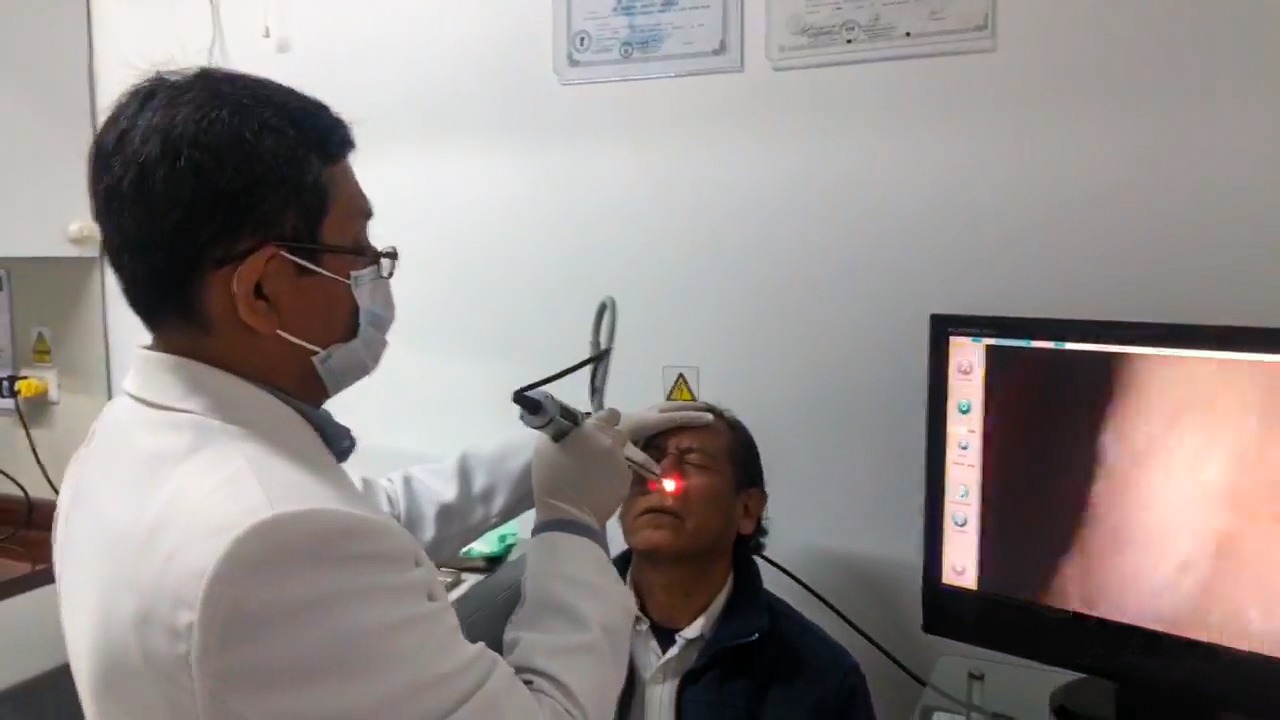 ¿Cómo podemos prevenir la rinitis? Especialista de Sisol Salud aclara tus dudas