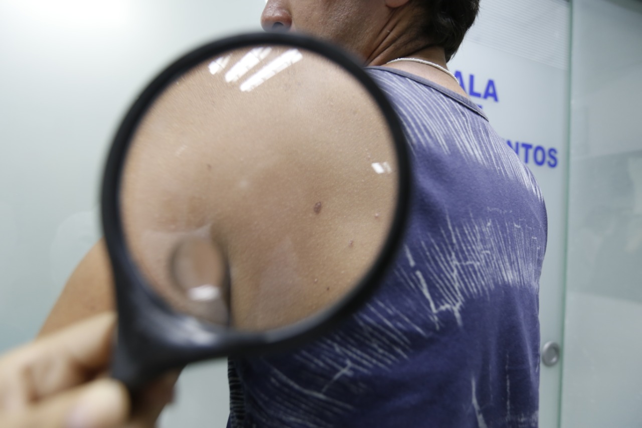 Estos son los pasos que debes seguir para cuidar tu piel en verano